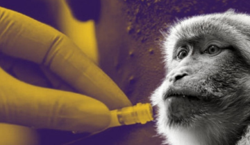 España registra la cifra más alta de contagios de viruela del mono
